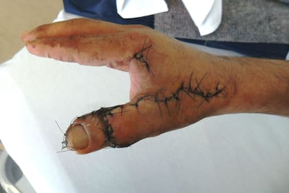 El dedo de un pie, en la mano