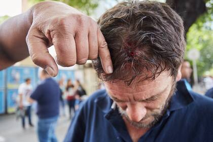 El delegado mendocino de la Unión Personal de Seguridad de la República Argentina (UPSRA), Ariel Edgechman, muestra las heridas sufridas.