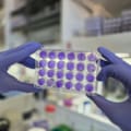 El hallazgo de un grupo de científicos argentinos que podría servir para frenar virus actuales y futuros