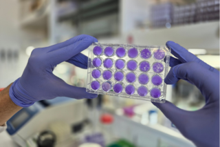 El hallazgo de un grupo de científicos argentinos que podría servir para frenar virus actuales y futuros