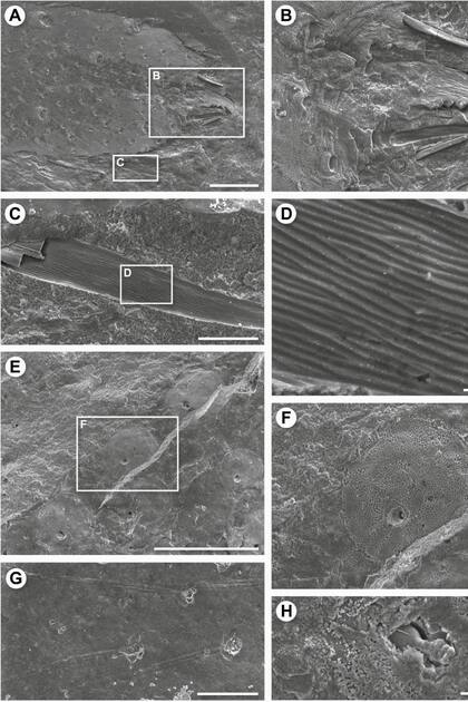 El detalle de las microfotografías que se le sacaron al ejemplar de araña fosilizado que fue hallado en Australia
