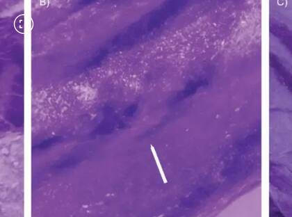 El detalle de los tatuajes (Foto: Gentileza Cambridge University Press en nombre de Antiquity Publications Ltd)