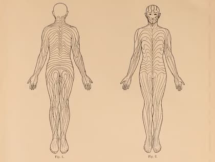 El diagrama de las líneas nevus, "la quintaesencia" del trabajo de Blaschko