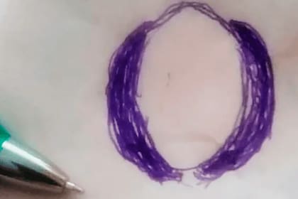 El dibujo con forma de "nuez invertida" que realizó el testigo