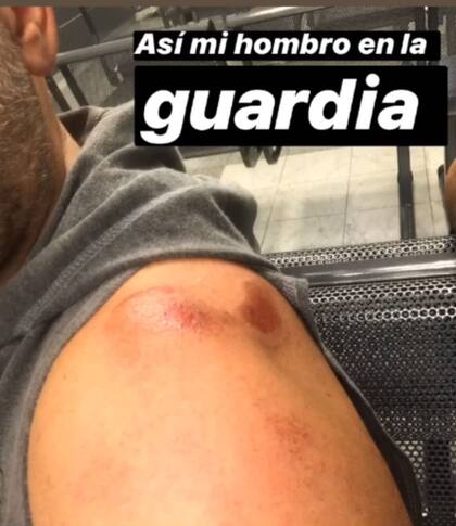 El director de Sex expuso sus heridas en las historias de Instagram