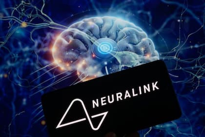 El dispositivo de Neuralink transmite la actividad cerebral de forma inalámbrica.