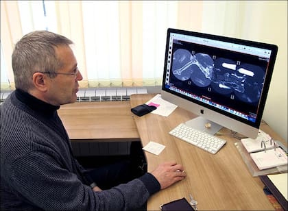 El doctor Andrey Letyagin observa la resonancia magnética que ayudó a determinar el cáncer que aquejaba a la mujer de Altái