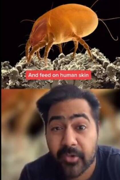 El doctor Karan Raj ilustró sus explicaciones con imágenes aumentadas de los ácaros que habitan en las sábanas de los seres humanos, y que necesitan calor y humedad para sobrevivir