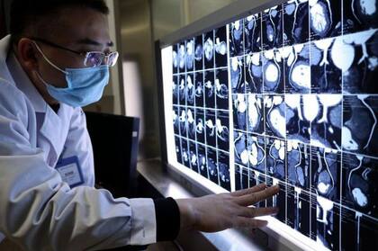 El efecto Compton es lo que permite conocer información detallada sobre la composición y densidad de los tejidos, creando imágenes tridimensionales de alta resolución que son claves para la medicina