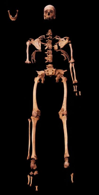 El esqueleto reveló detalles extraordinarios sobre la vida del hombre