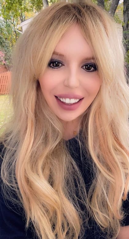 El estadounidense inició con sus cirugías a los 17 años