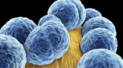 La comunidad de científicos está preocupada por las llamadas "bacterias pesadilla"