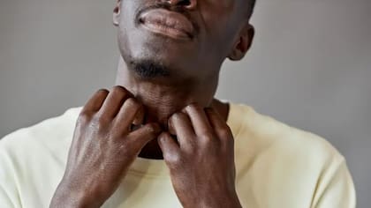 El estrés puede empeorar la picazón. Y la picazón puede empeorar el estrés