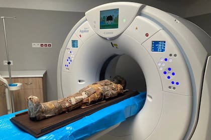El examen radiológico sistemático sirvió para poder explorar el interior del cuerpo de la momia