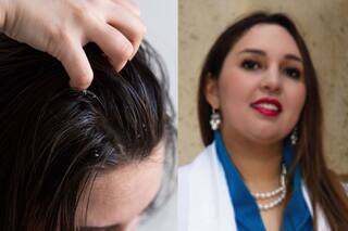 Es dermatóloga en Miami y revela qué es lo que realmente le pasa a tu pelo si no lo lavas