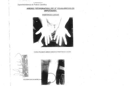 El expediente de la causa con fotos de las lesiones de Lucas Pertossi