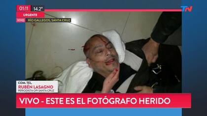 El fotógrafo Jorge Riquelme, Prensa de ATE, está herido con un corte en la cabeza y fue trasladado a un hospital