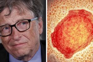El pronóstico que Bill Gates hizo sobre la viruela y podría estar próximo a volverse realidad