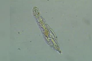 Descubren una superbacteria de 5000 años en el permafrost resistente a los antibióticos modernos