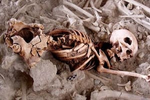 El hallazgo que sorprende a los arqueólogos: el logro de los médicos hace 4500 años
