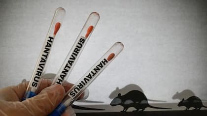 El hantavirus es una cepa de virus transmitida por roedores, pero también puede transmitirse de persona a persona, aunque es poco común