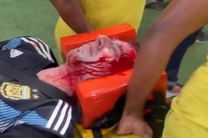 El relato del hincha que se golpeó la cabeza y se desmayó durante la golpiza de la Policía en el Maracaná