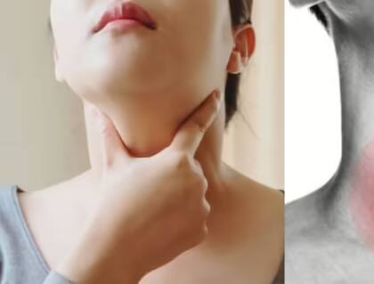 El hipotiroidismo puede reflejarse en el cabello