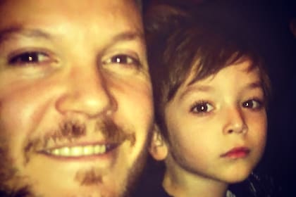 El hombre fue diagnosticado con estenosis valvular aórtica severa