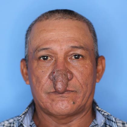 El hombre había visitado a varios médicos durante toda su vida, pero ninguno había podido ayudarlo