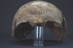 Hallaron evidencia de un nuevo paciente cero de la peste negra de hace más de 5000 años