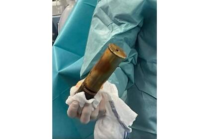 El hombre se introdujo artillería de la Primera Guerra Mundial