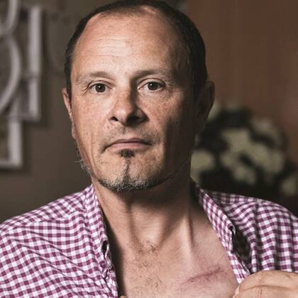 El implante de Matt Eagles le dejó una cicatriz en el pecho y dos protuberancias en su cabeza