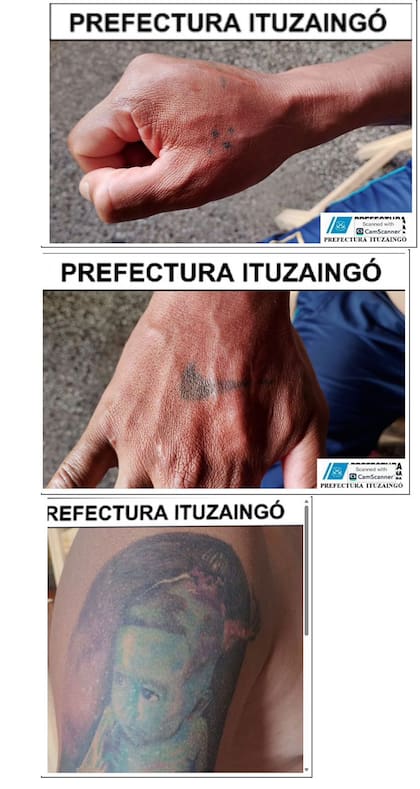 El imputado presenta 20 cicatrices compatibles con heridas de arma blanca y tatuajes asociados al Tren de Aragua