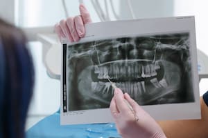 El insólito caso se convirtió en un trabajo de investigación para los especialistas que optaron por realizarle una cirugía para removerlo