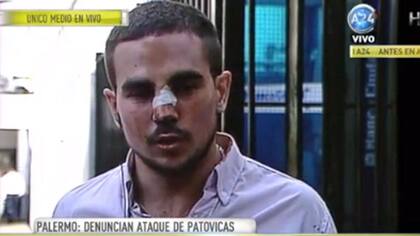 El joven agredido en un boliche de Palermo
