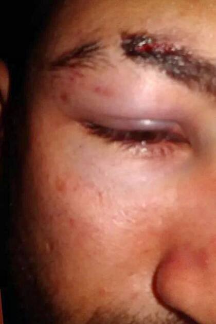 El joven atacado compartió imágenes de las consecuencias de la golpiza en sus redes sociales