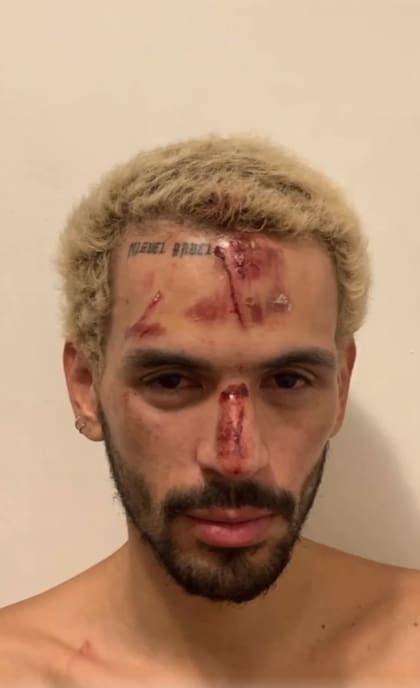 El joven denunció que fue golpeado por su orientación sexual