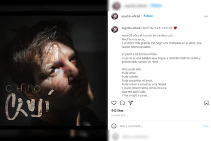 El joven reveló cómo fue el proceso de composición de su canción (Foto Instagram @soychio.oficial)