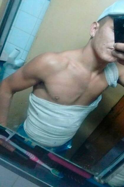 El joven sufrió quemaduras al explotarle el celular