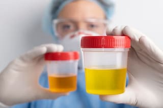 Calor en aumento: el dato que puede revelarnos la orina y que debemos atender cuanto antes en verano