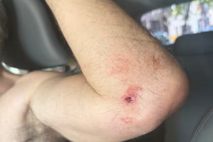 El médico terminó con heridas en el rostro, el brazo izquierdo y cortes en distintas partes del cuerpo
