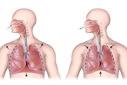 El monóxido ingresa al cuerpo a través de los pulmones y reemplaza al oxígeno.