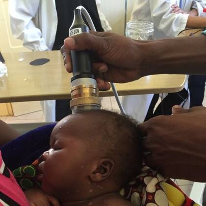 El "Neosonics" toma una imagen de ultrasonidos de alta resolución del líquido cerebroespinal de la cabeza que permite detectar la meningitis.