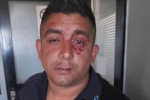 El oficial subayudante Marcelo Ezequiel Bogado, de la subcomisaría del Barrio Rojas, de Tigre, tras ser golpeado por familiares de una chica que fue a denunciar un hecho de violencia de género y terminó siendo acosada