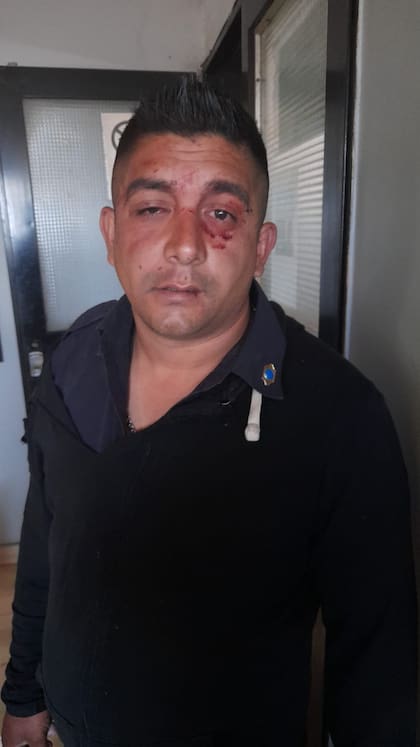 El oficial subayudante Marcelo Ezequiel Bogado, de la subcomisaría del Barrio Rojas, de Tigre, tras ser golpeado por familiares de una chica que fue a denunciar un hecho de violencia de género y terminó siendo acosada
