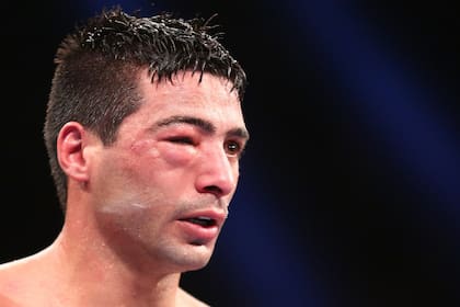 El ojo inflamado de Lucas Matthysse
