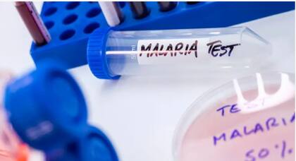 El olor de una persona puede revelar si se ha contagiado de malaria