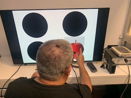 El paciente que recuperó parcialmente la visión natural tras participar en un ensayo clínico de estimulación eléctrica