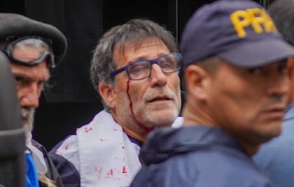 El Padre Paco, herido (foto de Nicolás Hernández)