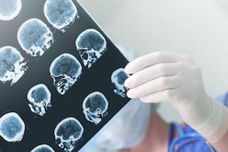 Una paciente con Parkinson tocó el clarinete durante una cirugía cerebral